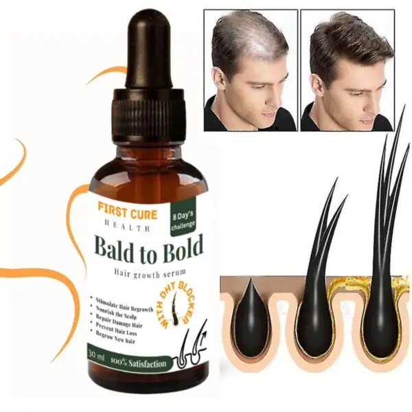 Bald To Bold - Image 5