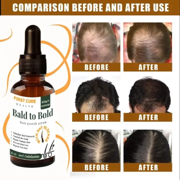 Bald To Bold - Image 4